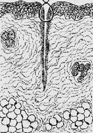 经缝合,创缘对合,炎症反应轻