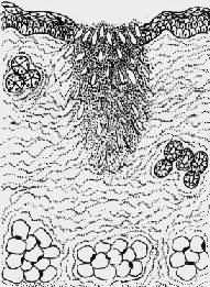 肉芽组织从伤口底部及边缘将伤口填平,然后表皮再生