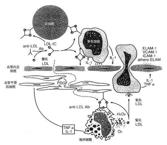 动脉硬化疾病机制中的免疫反应(假说)