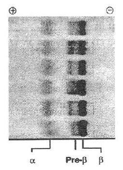 血清脂蛋白电泳(琼脂糖)