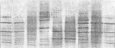 IEF-PAGE图(平板电泳)