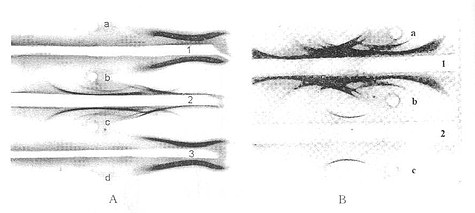 免疫电泳图(琼脂糖凝胶)