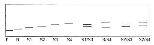 几种Apo(a)表型的免疫印迹分析示意图谱