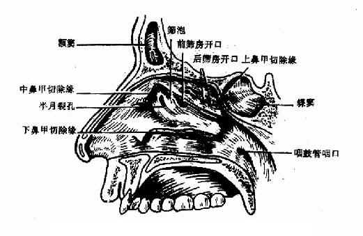 鼻腔外侧壁(上、中、下鼻甲部分去除)