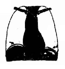 气腹 膈下新月状透明带