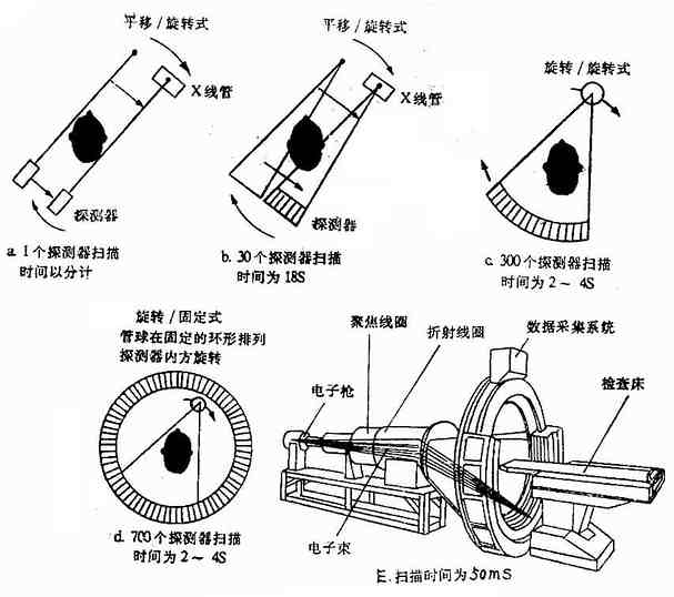 第1-5代(CT)扫描方式