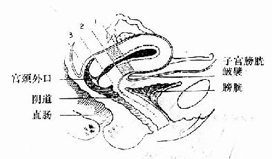 子宫矢状剖面图,示峡部