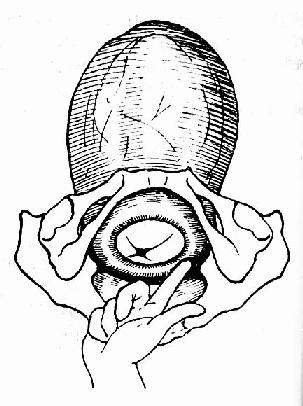 来回触摸宫口边缘,估计开大程度