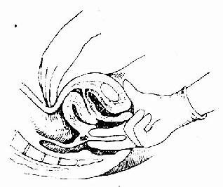 三合诊(食、中指)