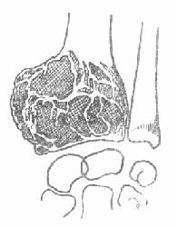 ����¶˾�ϸ����