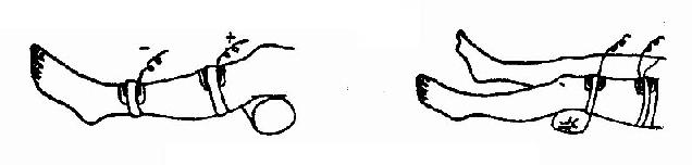 左大腿和小腿前面的并置法