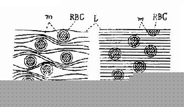 低、高频电流通过组织细胞进的情形