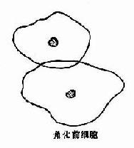 复层扁平(鳞状)上皮各层脱落细胞示意图