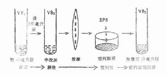 尿液和前列腺液分段定位培养示意图