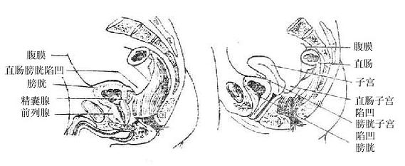 男女骨盆矢状切面(示腹膜与脏器关系)