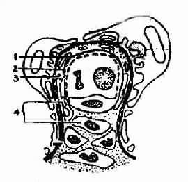 膜-增殖性肾小球肾炎模式图