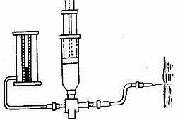 筋膜间寅压测定:针头血压计测定法示意图