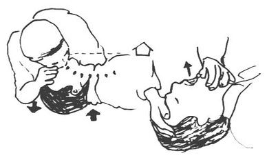 口对口人工呼吸