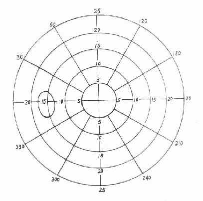 平面视野计记录表(左眼)