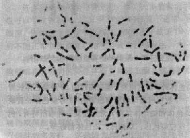 一个癌细胞的染色体共104条,包括许多异常的染色体