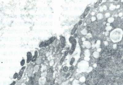 Hp密集地粘附于胃上皮细胞表面超薄切片,透射电镜