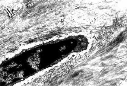 小鼠骨细胞和骨基质(脱钙后)电镜像
