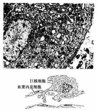 �˾޺�ϸ���羵�� 