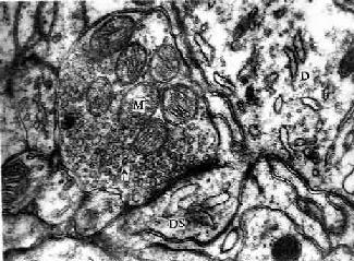 ����С�Ե羵��ʾͻ�� 