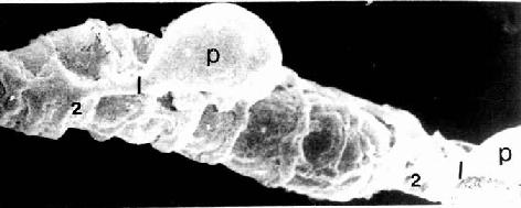 毛细血管 扫描电镜像示周细胞