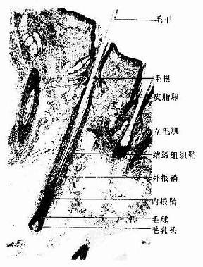 人头皮光镜像(低倍) HE