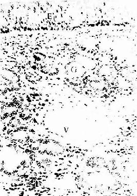 人鼻呼吸部粘膜