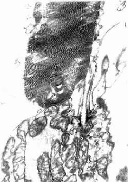 人视杆细胞外突电镜像