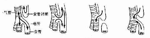 ����ʳ���� 