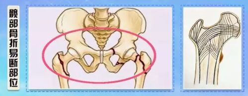 �Ų������׶ϲ�λ