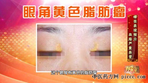 20180806:«,Ѫ֬,Թ,Ĺ,Ѫ֬һոһ