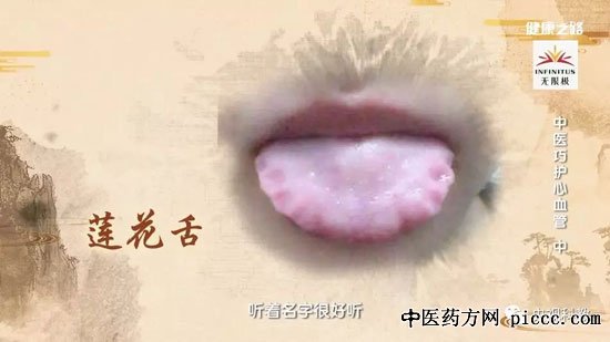 健康之路20180824:郭力恒,山楂降脂饮,陈皮粥,中医巧护心血管