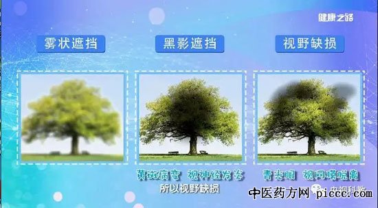 健康之路20180902:魏文斌,眼部疾病黄斑病变,视网膜脱落