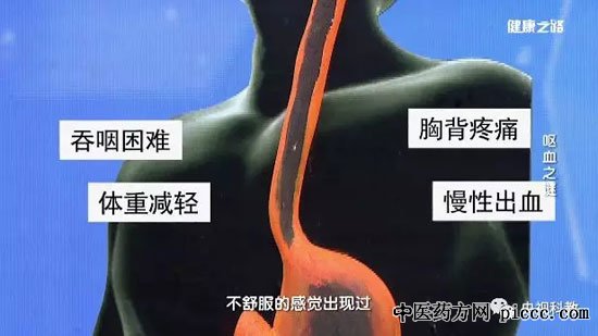 健康之路20180904:曹庆东,食道癌临床体现,食道癌前期症状