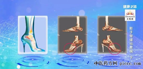 健康之路20180907:张建中,高跟鞋拇外翻,糖尿病足健康危险
