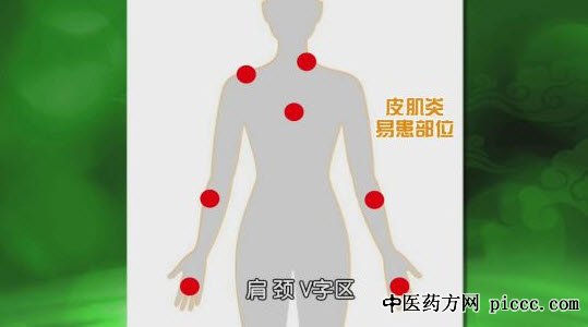 饮食养生汇20181023:沈冬,图解皮肤变质本性,皮肤与癌症相关