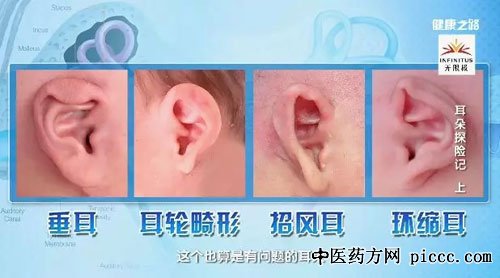 健康之路20181119:马芙蓉,耳廓畸形,外耳道胆脂瘤,耵聍