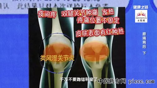 ½¡¿µÖ®Â·20181130:Åí½,ϥʹ±³ºó,Ï¥¹Ø½ÚµÄ²»Í¬ÌÛÍ´·½Ê½