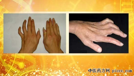 20181220:,,ֹµΣ,򲡲֢