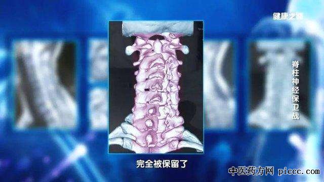 健康之路20190109:菅凤增,陈赞,吴浩,脊柱神经保卫战