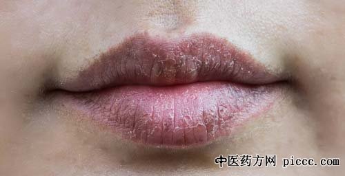 健康之路20190330:朱跃兰,口干乌梅膏,眼干石斛夜光丸,润目熏蒸方