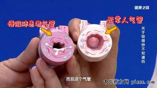 健康之路20190528:赵迎,吸烟你不知道的隐秘,造成肺癌的元凶