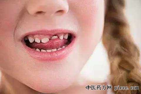 健康之路20190626:郑颖,护牙你不知道的秘密,牙髓治疗需要早