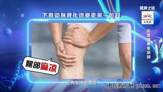 健康之路20190911:张鸿坤,血管健康看腿脚,下肢动脉硬化闭塞症的治疗