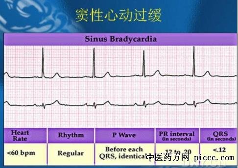 健康之路20190917:马长生,心脏历险记,窦性心动过缓的表现及病理原因