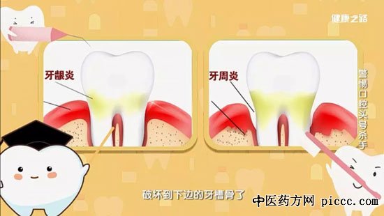 ½¡¿µÖ®Â·20191119:Ð챦»ª,ÑÀÖÜÑ××Բⷽ·¨,ÑÀÖÜÑ׺ÍÑÀö¸Ñ×µÄÇø±ð